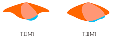 STL-SERIES（images 7）